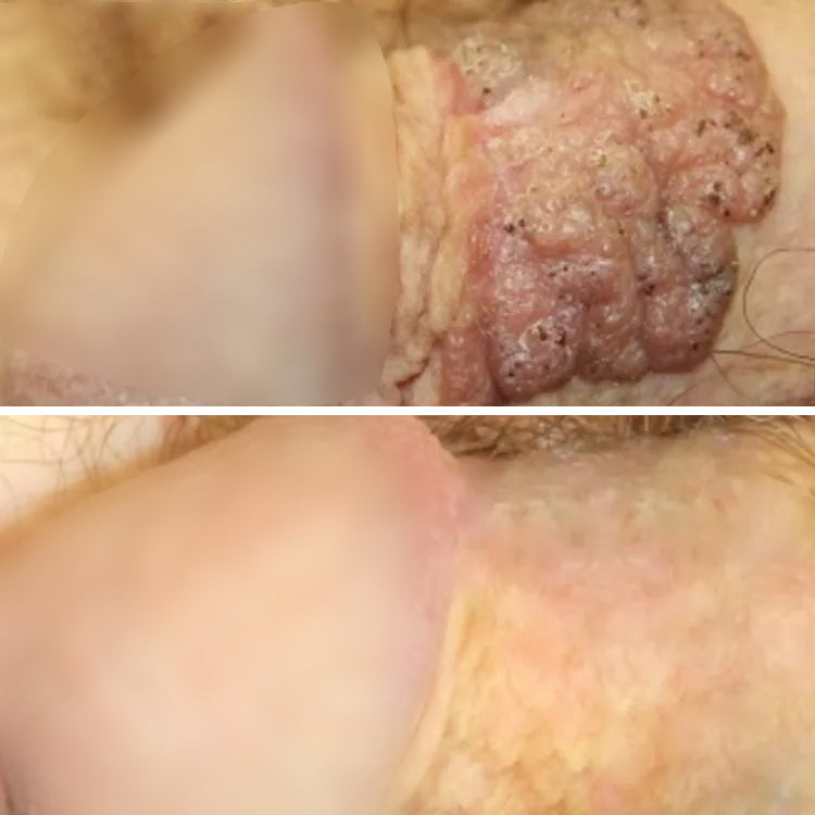 AEXZR® Herbal Genital Skin Care Cream