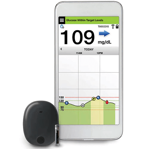 Eversense Monitor