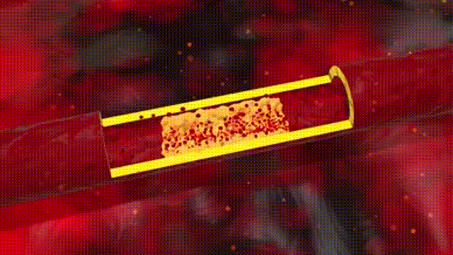 1716734575405214.gif 1711955541343172.gif