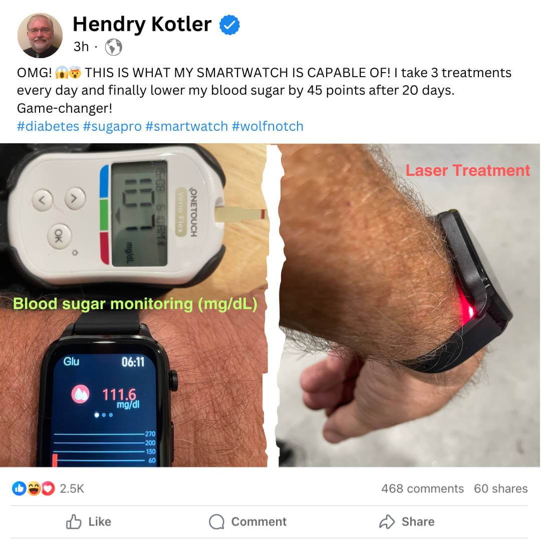 Blood Sugar Monitor Watch
