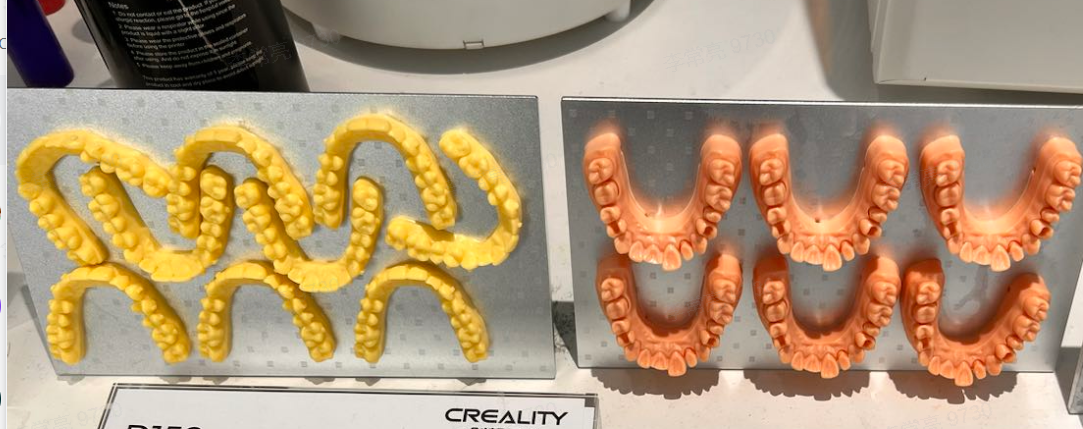 3D Printed Teeth